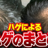 ハゲ対策記事のアイキャッチ