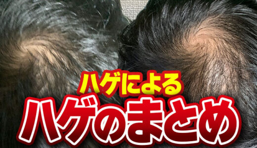 【必見】ハゲは治らない！？20代若ハゲの対策や治療法など総まとめ！！