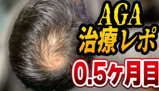 30代若ハゲAGA治療レポート0.5ヶ月目。いまだ何も起きず。